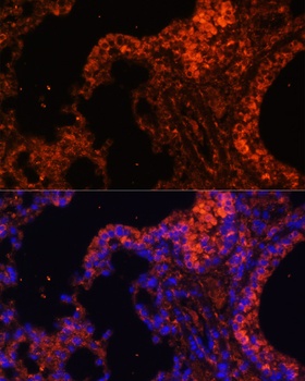 SPTA1 Antibody