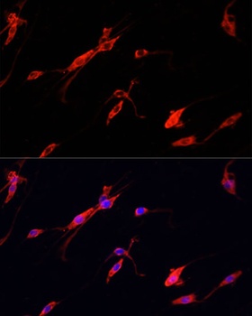 ENO2 Antibody