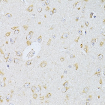 NTS Antibody