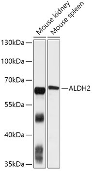 AMPK alpha 1 Antibody