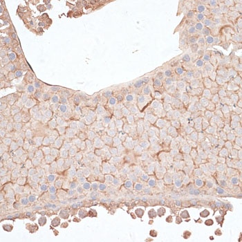 KIAA1524 Antibody