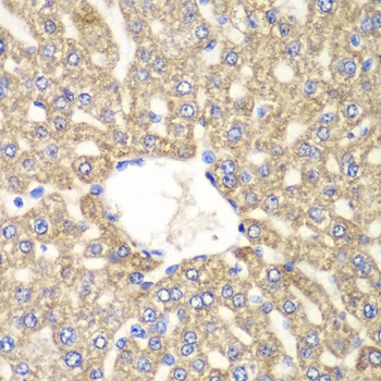 ALDH2 Antibody