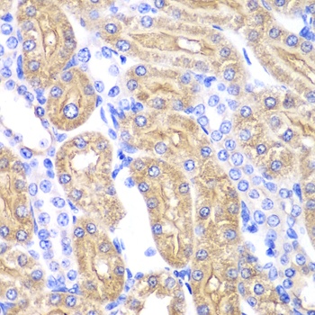 ALDH2 Antibody