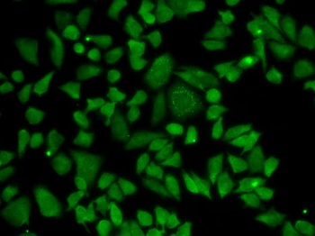 ALDH2 Antibody