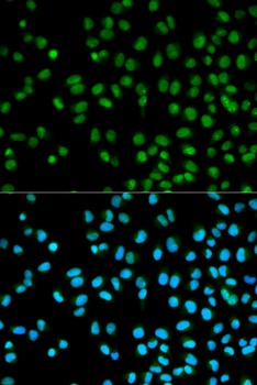 CST8 Antibody