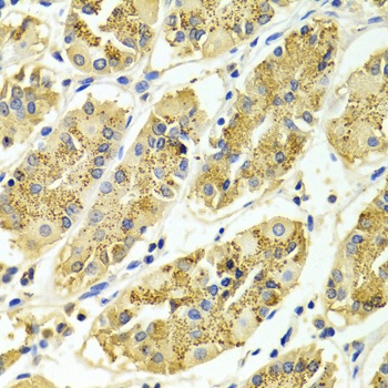 ARHGAP25 Antibody