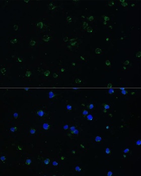 ARHGAP25 Antibody