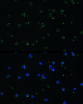 ARHGAP25 Antibody