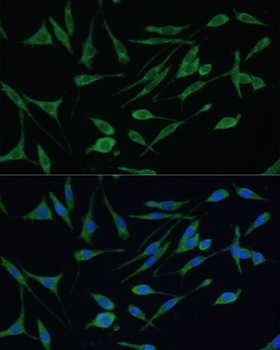 ARHGAP25 Antibody