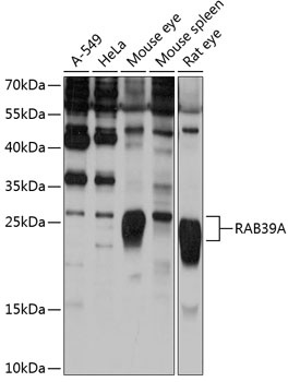 RAB39A Antibody