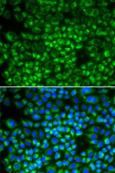 SHMT2 Antibody