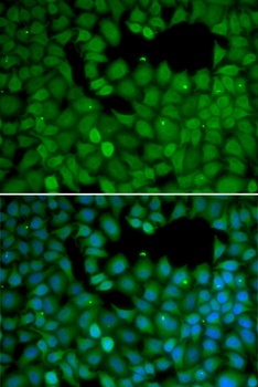 NET1 Antibody