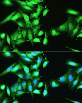 STAT1 Antibody