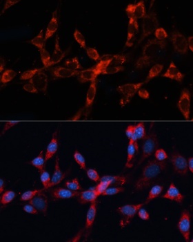 CTSL Antibody
