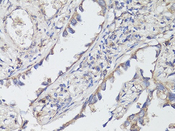 TrkB Antibody