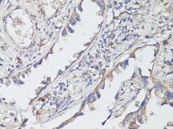 NTRK2 Antibody