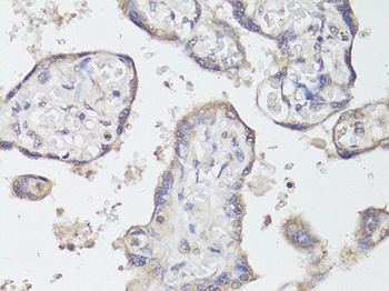 TrkB Antibody