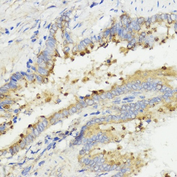 IGF1 Antibody