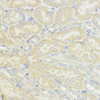 IGF1 Antibody