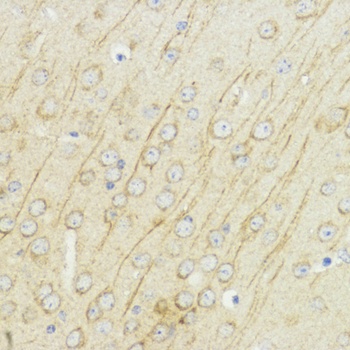 IGF1 Antibody