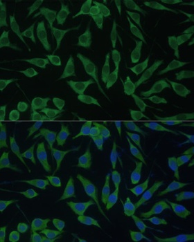 IGF1 Antibody