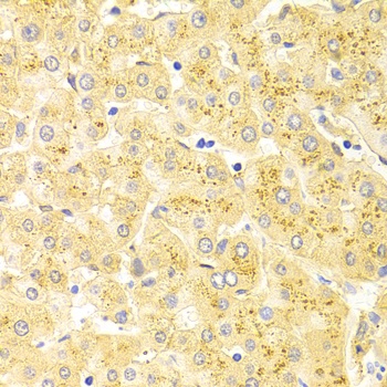 WT1 Antibody