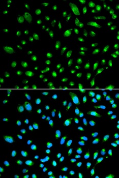 WT1 Antibody