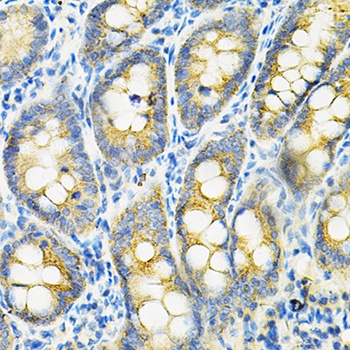 HGF Antibody