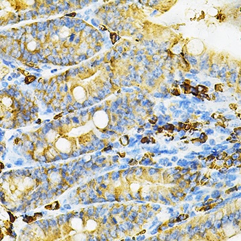 HGF Antibody