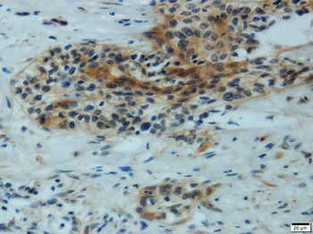 MMP1 Antibody