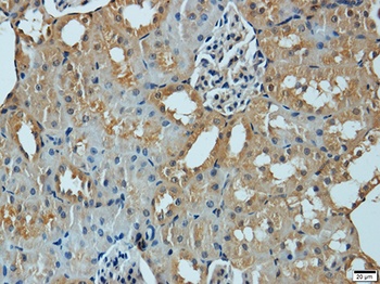 MMP1 Antibody