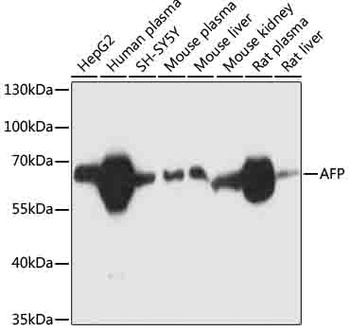 AFP Antibody