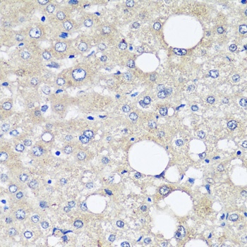AFP Antibody