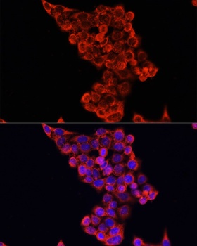 CD8A Antibody