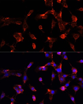 CD8A Antibody