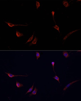 CD8A Antibody