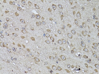 SNAI1 Antibody