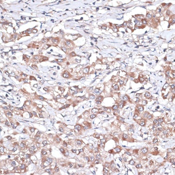 TGFBR2 Antibody