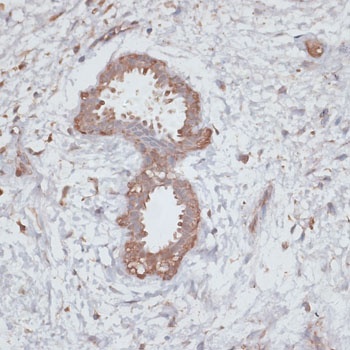TGFBR2 Antibody