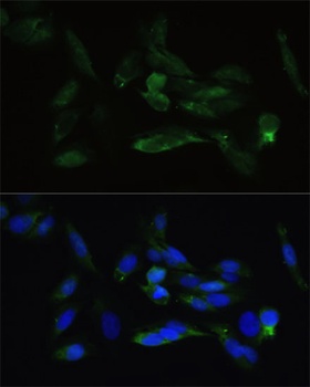 TGFBR2 Antibody