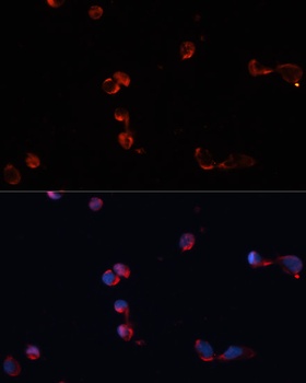 CAT Antibody