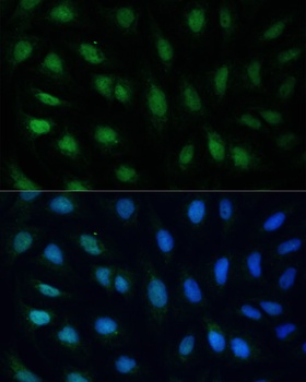 GADD45A Antibody