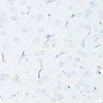 ABCB1 Antibody