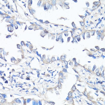 ABCB1 Antibody