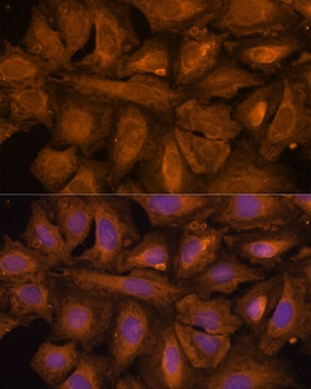 STUB1 Antibody