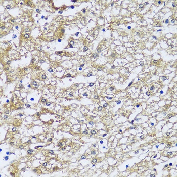 NQO2 Antibody