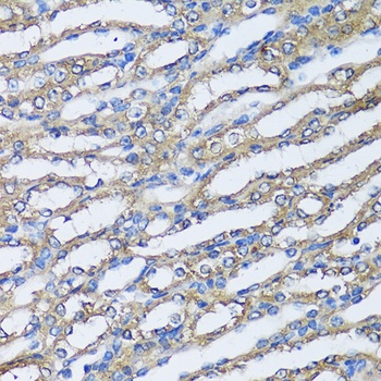 NQO2 Antibody