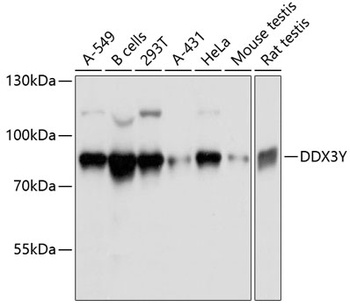 DDX3Y Antibody