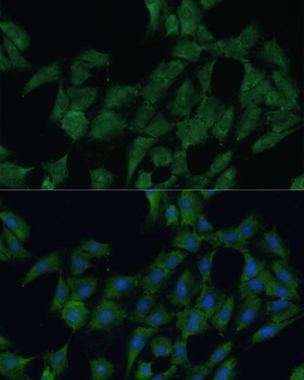 DDX3Y Antibody