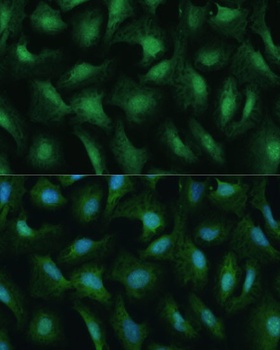 DDX3Y Antibody